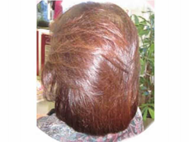 Mさま(50代・女性)