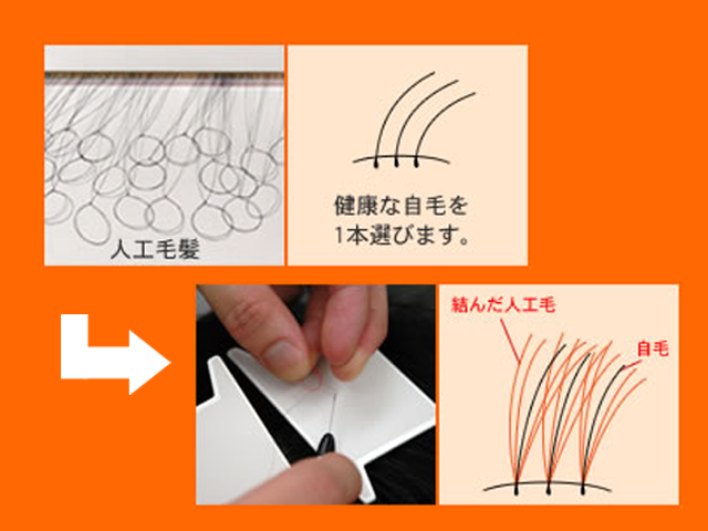特許増毛ライン法を用いて結んでいきます